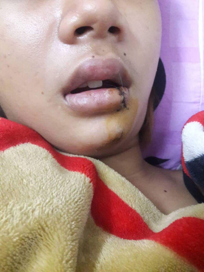 thieu nu 14 tuoi ke lai thoi khac kinh hoang khi bi nhom thanh nien chan duong truy sat giua dem o sai gon