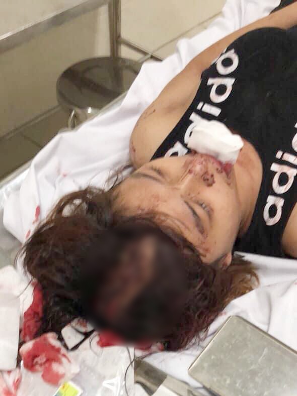 cong an thong tin bat ngo vu co gai 14 tuoi bi nhom thanh nien truy sat giua dem o sai gon