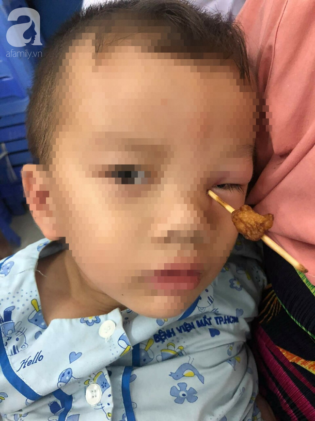 vap nga khi chay phu cha day xe be trai 4 tuoi bi xien ca vien dam sau vao hoc mat