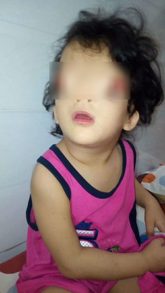 khat vong anh sang cua be gai 4 tuoi mang guong mat quy