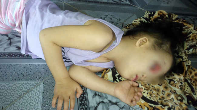 khat vong anh sang cua be gai 4 tuoi mang guong mat quy