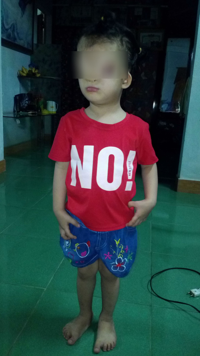 khat vong anh sang cua be gai 4 tuoi mang guong mat quy