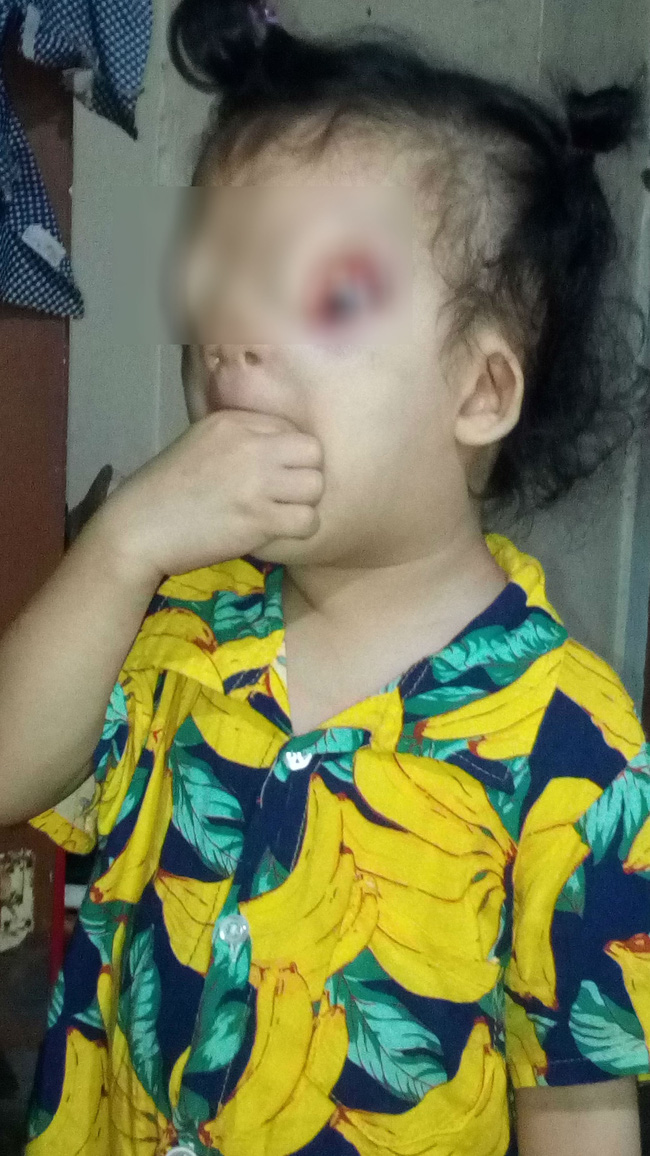 khat vong anh sang cua be gai 4 tuoi mang guong mat quy