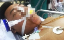 vu benh nhan 19 tuoi tu vong tai bv cho ray bac si nguoi nha xin loi nguoi me phan bac