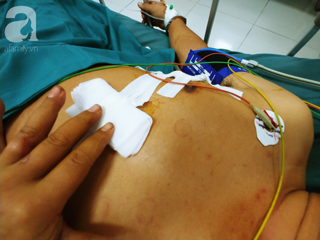 tphcm bop coi xin duong lien tuc nhung bi tan cong tai xe container dam chu xe may chet tai cho