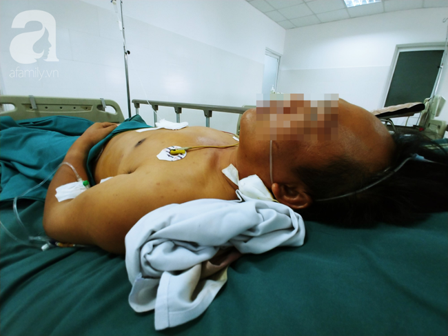 tphcm bop coi xin duong lien tuc nhung bi tan cong tai xe container dam chu xe may chet tai cho