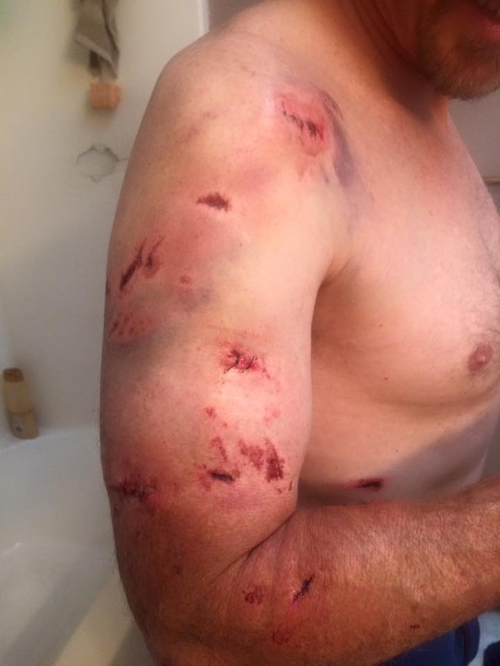 thoat chet than ky sau 2 lan bi gau du tan cong