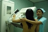 tam soat ung thu vu mien phi cho 10000 phu nu tu 40 tuoi tro len
