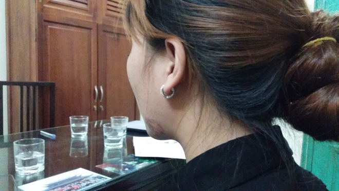 vu co gai bi lot ao tren pho hang ma toi an han vi de xay ra xo xat