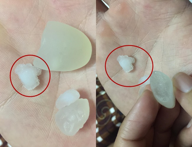 co gai bi cu dan mang nem da sau khi to hat dac cua quan che thai noi tieng da nang lam gia bang hat nhua