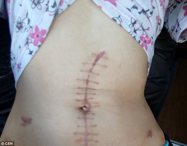 loi ke nghen ngao cua mot no le tinh duc toi bi tra tan hanh ha voi chang chit vet thuong tren co the