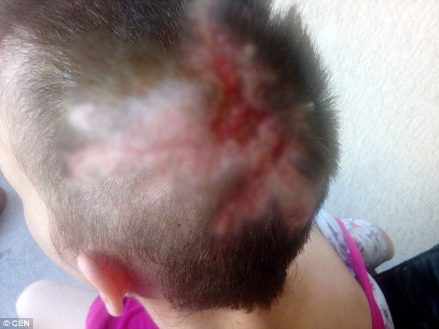 loi ke nghen ngao cua mot no le tinh duc toi bi tra tan hanh ha voi chang chit vet thuong tren co the