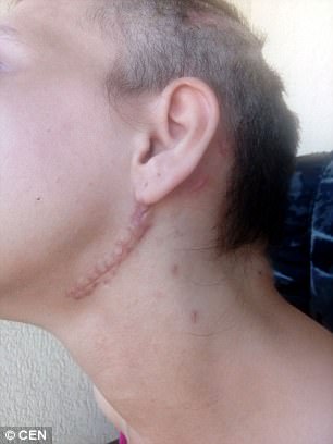 loi ke nghen ngao cua mot no le tinh duc toi bi tra tan hanh ha voi chang chit vet thuong tren co the