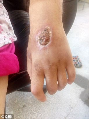 loi ke nghen ngao cua mot no le tinh duc toi bi tra tan hanh ha voi chang chit vet thuong tren co the