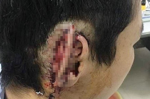 nghe an nam hoc sinh nghi phe co can dut tai ban roi nuot luon vao bung