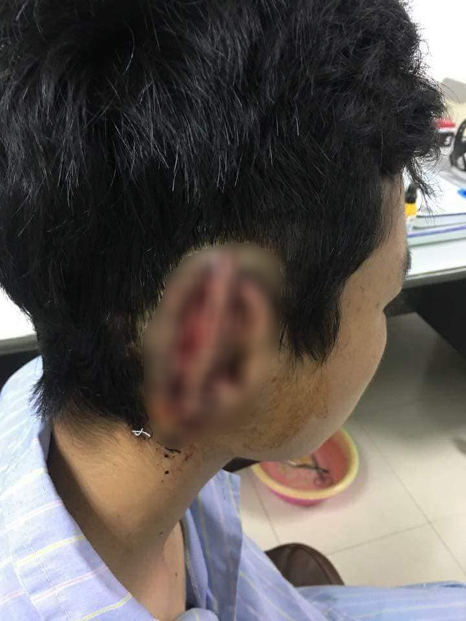 nam sinh can dut roi nuot tai cua ban vao bung am tinh voi ma tuy