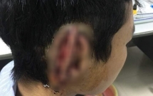 nam sinh can dut roi nuot tai cua ban vao bung am tinh voi ma tuy