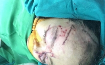 nghe an be gai hon 2 tuoi bi cho nha can nat vung mat