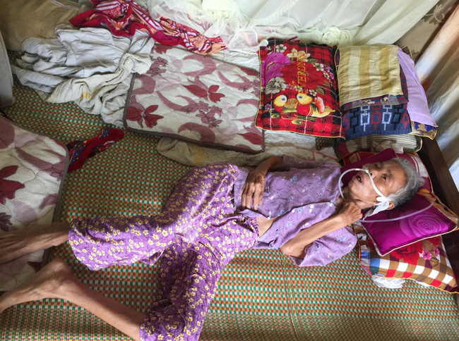 nghe an cu ong 85 tuoi bi ung thu suot nhieu nam gang guong cham vo nam liet giuong vi tai bien