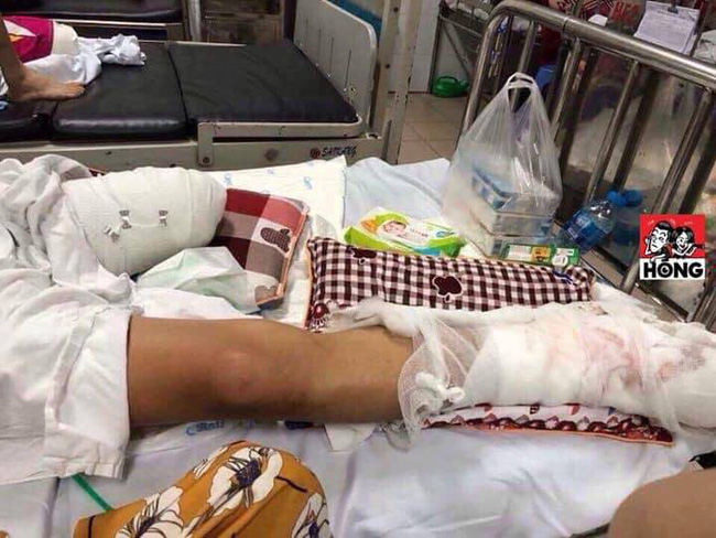 phu tho sau khi nhan tin nhan dung hoi tao la ai qua facebook nan nhan di ra duong bi chem nat chan