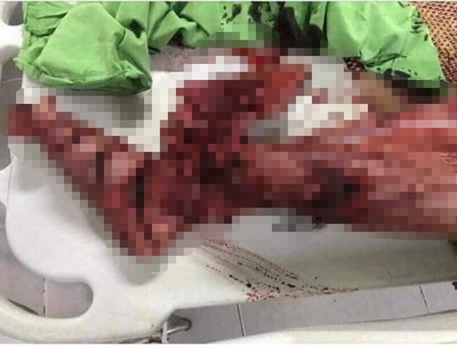 phu tho sau khi nhan tin nhan dung hoi tao la ai qua facebook nan nhan di ra duong bi chem nat chan