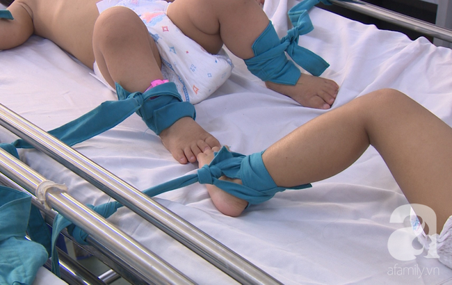 phu huynh can trong khi mom thuc an cho con da co hon 61000 nguoi mac tay chan mieng trong 9 thang dau nam