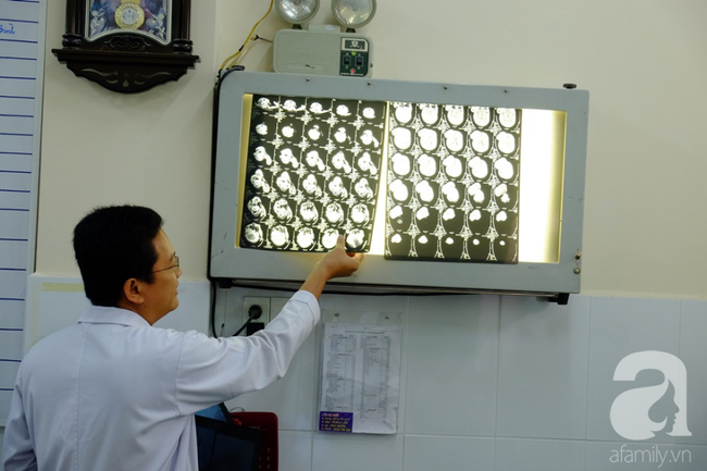 tphcm nu di nhan 10 nam khong dam ra duong vi guong mat vua chay vua noi cuc meo mo bien dang khung khiep