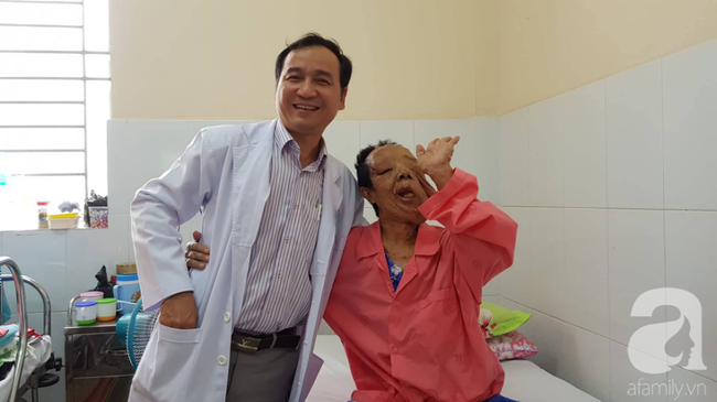 tphcm nu di nhan 10 nam khong dam ra duong vi guong mat vua chay vua noi cuc meo mo bien dang khung khiep