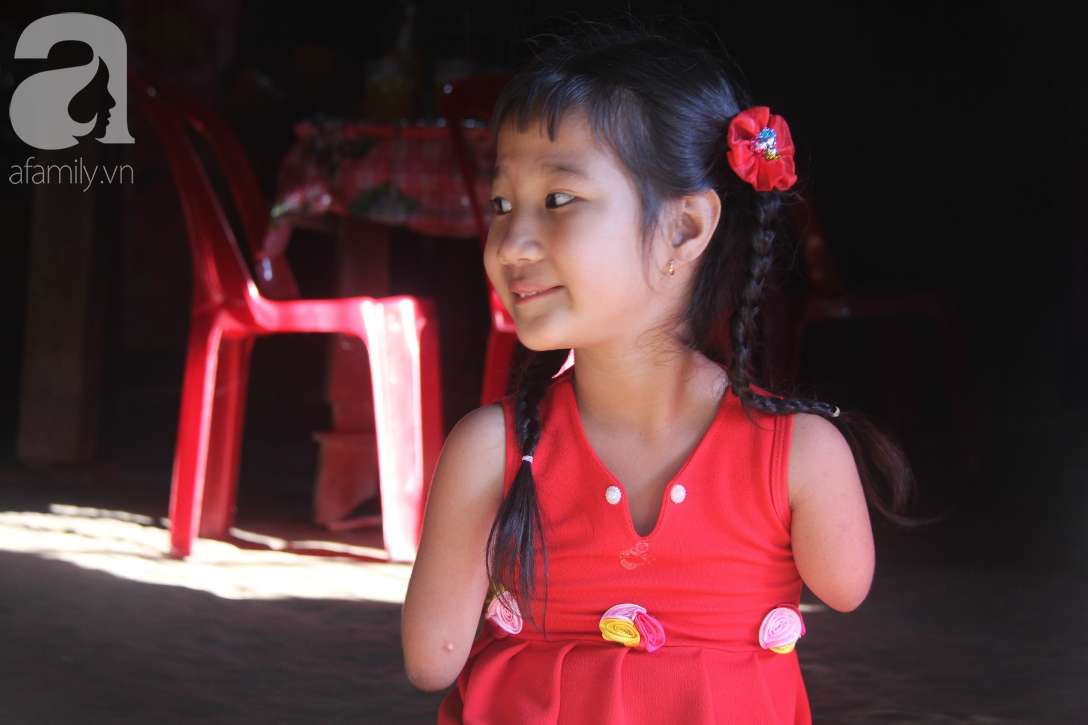 bo mat me di lay chong khac co be cut tay cut chan duoc moi nguoi giup do lap doi chan gia va di hoc tiep