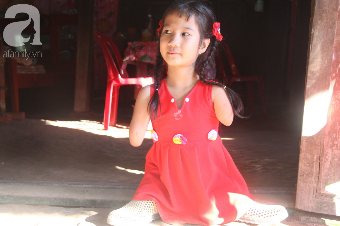 bo mat me di lay chong khac co be cut tay cut chan duoc moi nguoi giup do lap doi chan gia va di hoc tiep