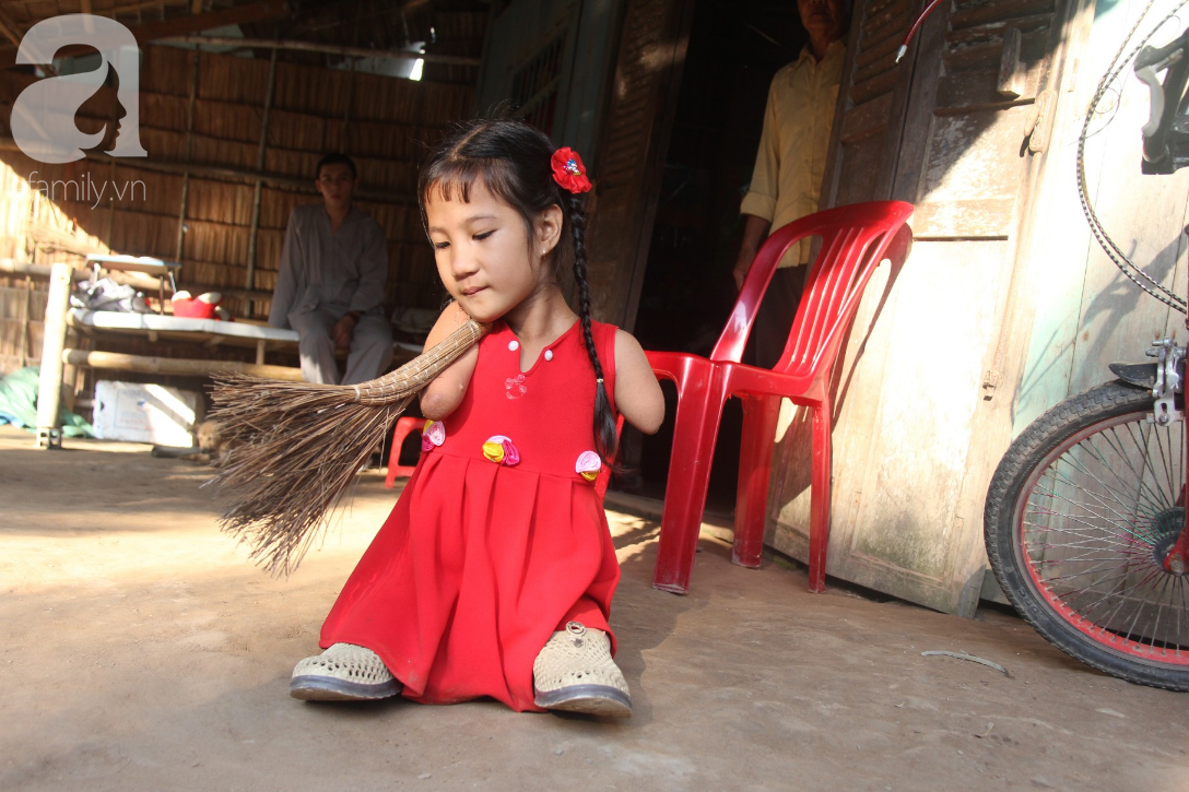 bo mat me di lay chong khac co be cut tay cut chan duoc moi nguoi giup do lap doi chan gia va di hoc tiep
