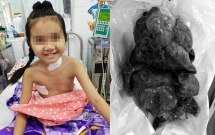 be gai dong nai kho tho suyt mat mang tren ban mo vi mang khoi u phoi chi 16 nguoi tren the gioi gap phai