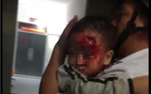 vu cha be con trai 3 tuoi mat be bet mau chay tim bac si kip truc di an toi