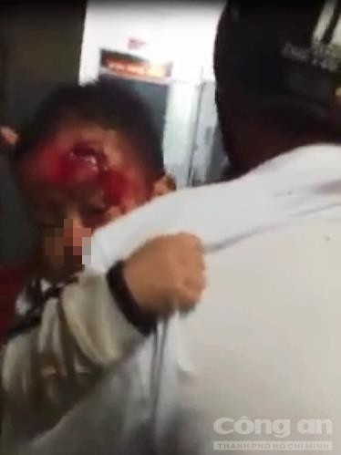 vu cha be con trai 3 tuoi mat be bet mau chay tim bac si kip truc di an toi