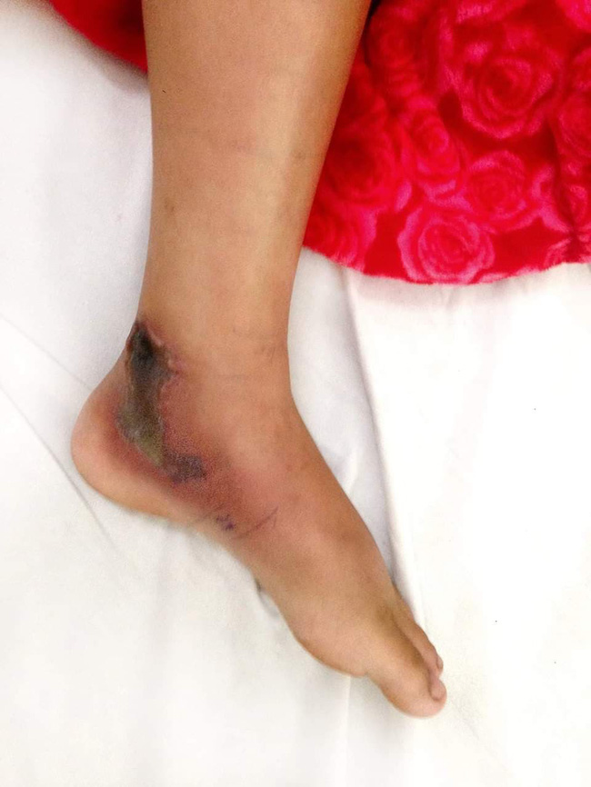 dong nai mo cua vao nha khi di hoc ve be gai lop 5 bi ran can trong thuong