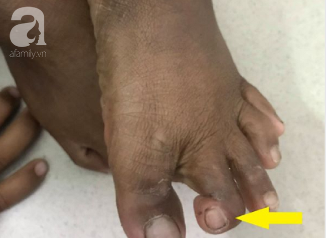 dong nai mo cua vao nha khi di hoc ve be gai lop 5 bi ran can trong thuong