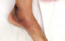 dong nai mo cua vao nha khi di hoc ve be gai lop 5 bi ran can trong thuong