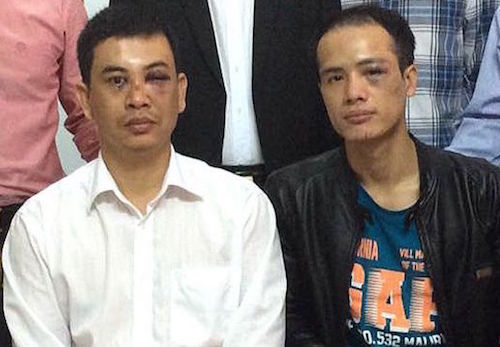 doan luat su ha noi khong dong tinh ket qua dieu tra cua cong an