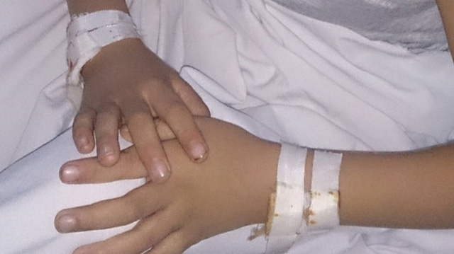 mo nham khong phai chuyen hiem