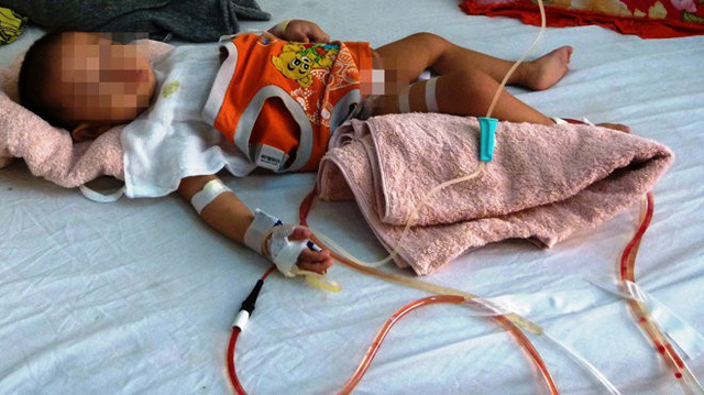 mo nham khong phai chuyen hiem