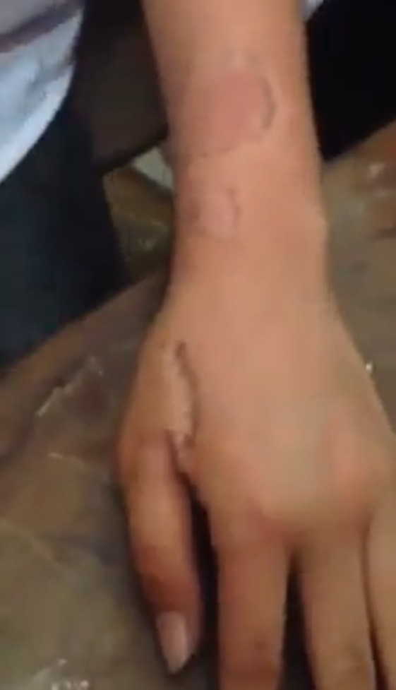 clip thieu nien can ban gai chay mau tay trong lop hoc