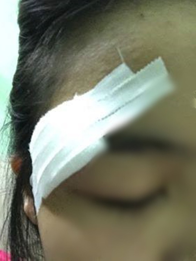 nu sinh sai gon bi ke bien thai tren xe buyt duoi danh rach mi mat cha phai dua di khau