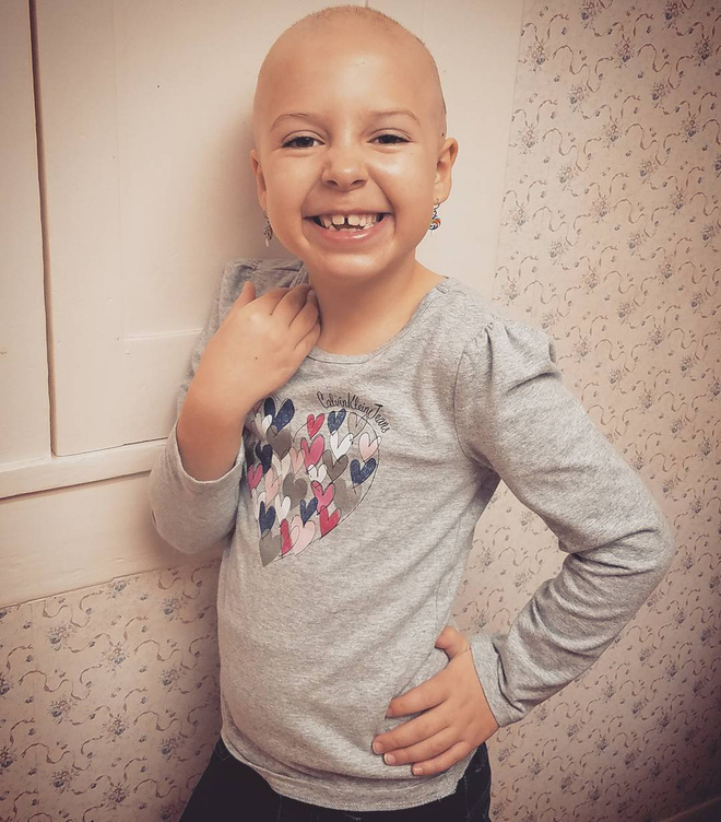 toc con vuong day luoc khi chai me nghi ngo can benh nay va day la chan doan chinh xac cua bac si