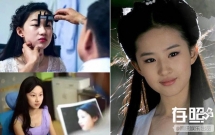 thoi buoi bay gio da ham mo cuong nhiet la phai phau thuat tham my cho xinh dep giong than tuong co