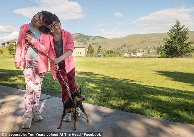 11 nam thang tram cua cap song sinh dinh lien phan dau tung duoc bac si du doan chi song khong qua 1 ngay