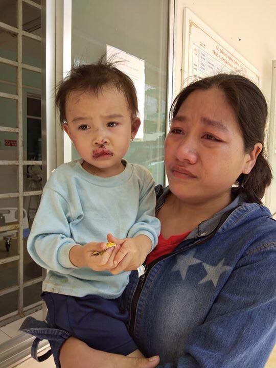 tham kich gia dinh sau vu sat lo dat o quang nam chong gay hai chan om con gai dau don ben thi the vo