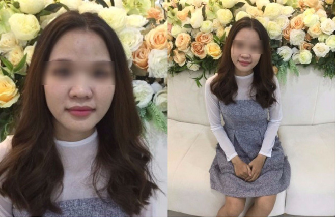 ky uc kinh hoang sau lan lam dep dai dot den bong rop ca mat cua co gai tre