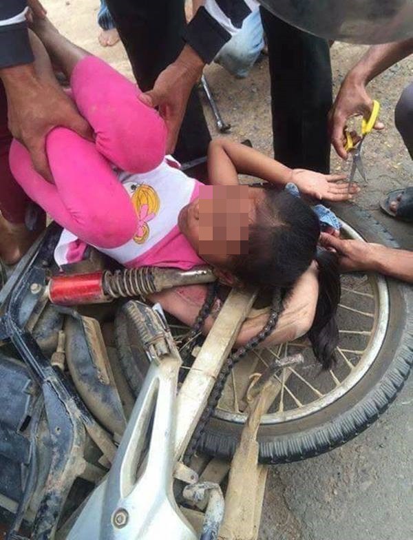 vu tai nan kho hieu cua be gai khien nguoi xung quanh hoang so