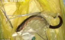luon chui vao hau mon nam gon trong co the nguoi dan ong