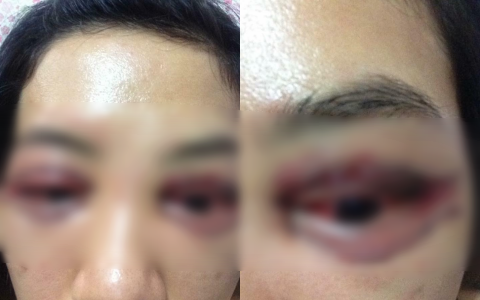 ben trong spa tham my tai ha noi noi co gai di cat mi mat gay xon xao mxh suot 2 ngay nay